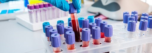 בדיקת התפלגות גודל תאי הדם האדומים בדם - (Red Cell Distribution Width -  RDW) - תמונה